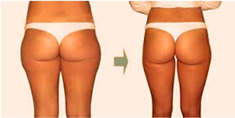 culotte de cheval zero C prima e dopo